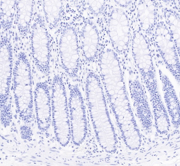 S-RMab® CD23 Recombinant Rabbit mAb (SDT-028-67)