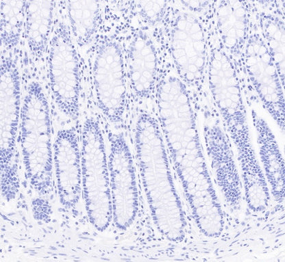 S-RMab® CD23 Recombinant Rabbit mAb (SDT-028-67)