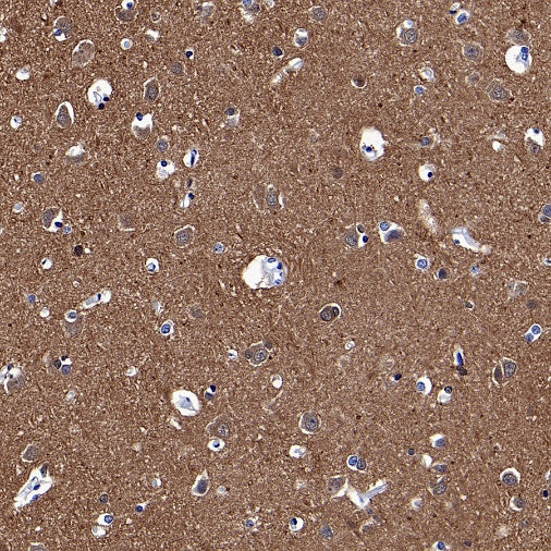 UCHL1 Rabbit Polyclonal Antibody