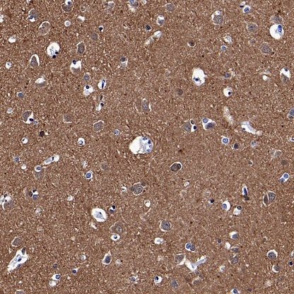 UCHL1 Rabbit Polyclonal Antibody