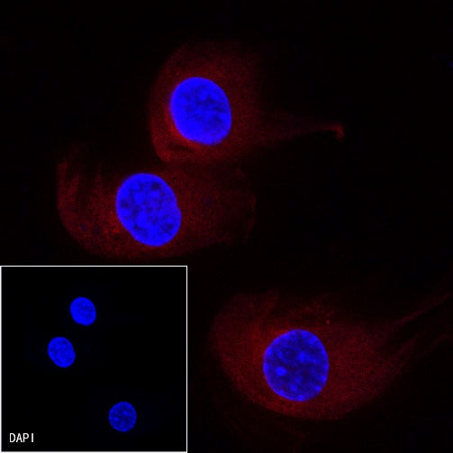 β-tubulin Recombinant Rabbit mAb (PE Conjugate) (S-312-113)