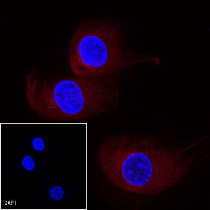 β-tubulin Recombinant Rabbit mAb (PE Conjugate) (S-312-113)