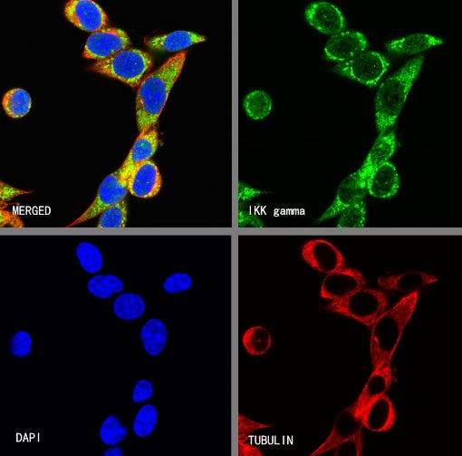IKK gamma Recombinant Rabbit mAb (S-1359-118)