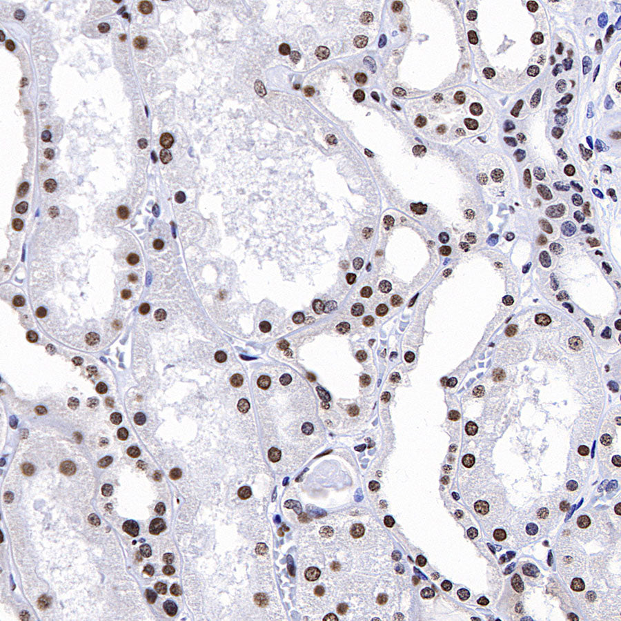 HNRNPA2B1 Mouse mAb