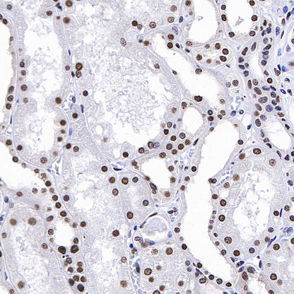 HNRNPA2B1 Mouse mAb