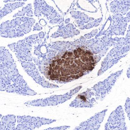 Insulin Recombinant Rabbit mAb (SDT-026-17)