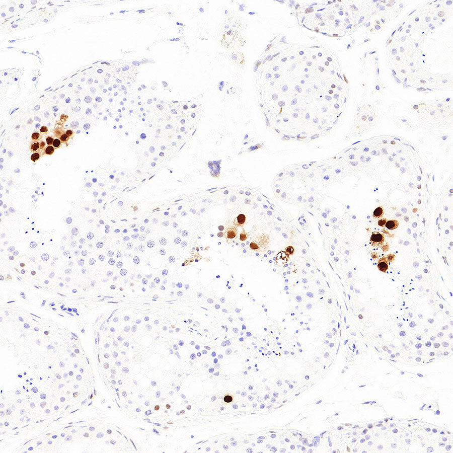 p57 Kip2 Recombinant Rabbit mAb (S-6119)