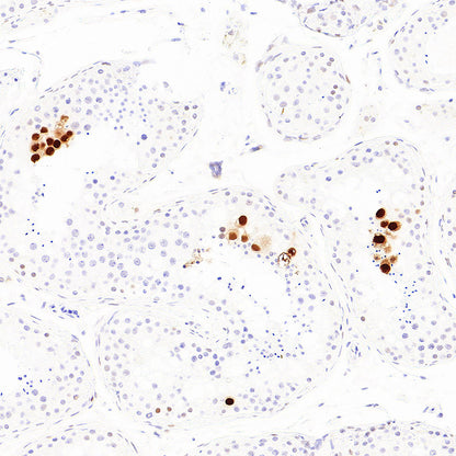 p57 Kip2 Recombinant Rabbit mAb (S-6119)