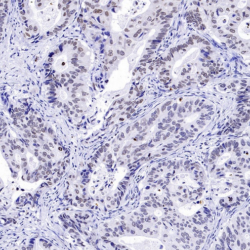 Histone H3 (mono methyl K36) Recombinant Rabbit mAb (S-859-505)