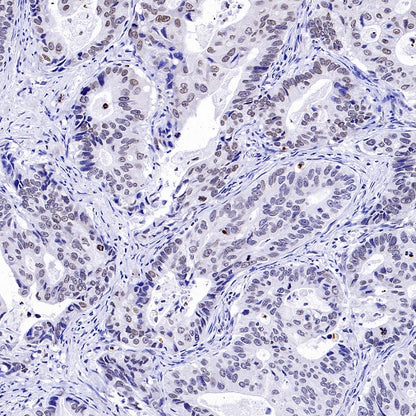 Histone H3 (mono methyl K36) Recombinant Rabbit mAb (S-859-505)