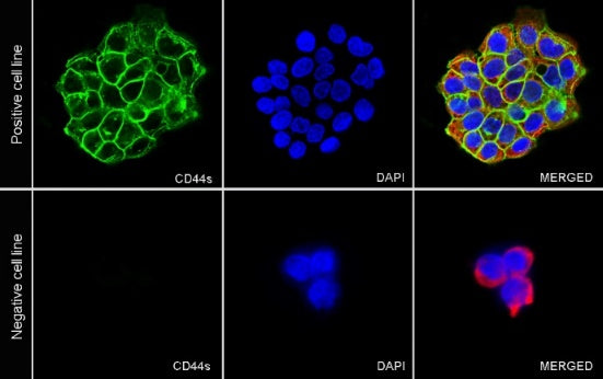 CD44 Recombinant Rabbit mAb (S-944-25)