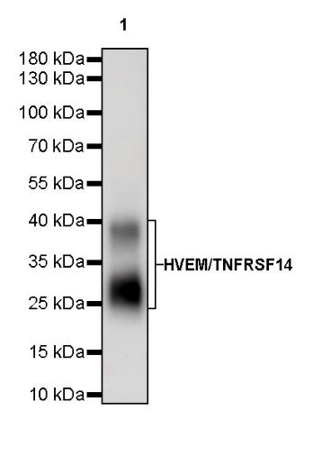 HVEM/TNFRSF14 Recombinant Rabbit mAb (S-727-70)