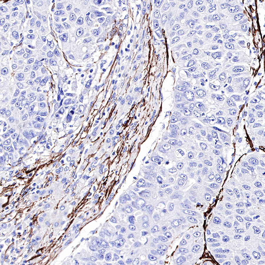 S-RMab® alpha smooth muscle Actin (SMA) Recombinant Rabbit mAb,PBS Only (SDT-301-142)