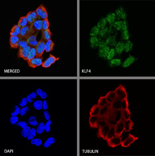 Klf4 Recombinant Rabbit mAb (S-2158-54)