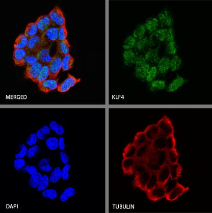 Klf4 Recombinant Rabbit mAb (S-2158-54)