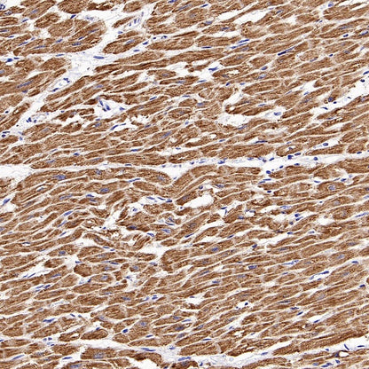 UQCRC2 Recombinant Rabbit mAb (S-1890-227)