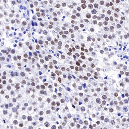 S-RMab®SALL4 Recombinant Rabbit mAb (SDT-R232)