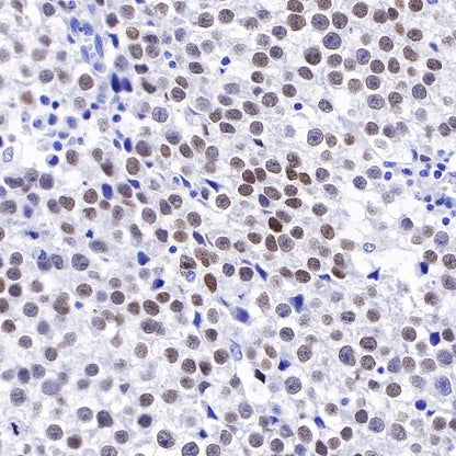 S-RMab®SALL4 Recombinant Rabbit mAb (SDT-R232)
