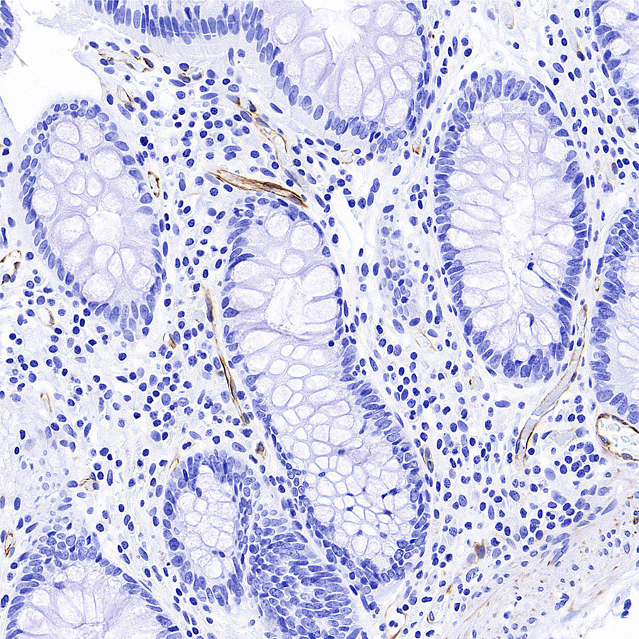 Nestin Recombinant Rabbit mAb (S-3890-112)