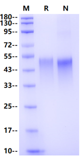 TNFR-2/CD120b His Tag Protein, Human