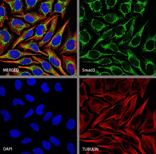 SMAD3 Recombinant Rabbit mAb (S-3147-36)