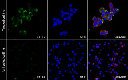 CTLA4 Recombinant Rabbit mAb (SDT-3348)