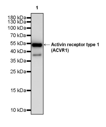 Activin receptor type 1 (ACVR1) Recombinant Rabbit mAb (S-2058-256)