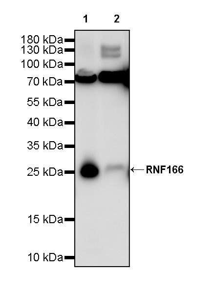 RNF166 Recombinant Rabbit mAb (S-3509-12)