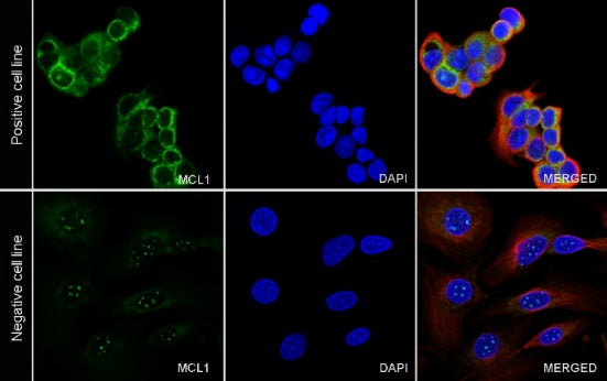 MCL1 Recombinant Rabbit mAb (S-772-109)