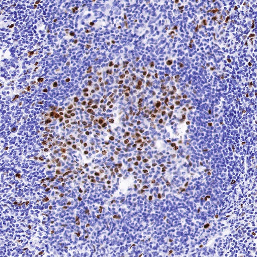 Topoisomerase II alpha Recombinant Rabbit mAb (S-513-7)