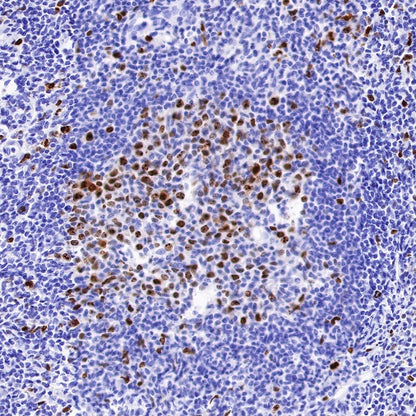 Topoisomerase II alpha Recombinant Rabbit mAb (S-513-7)