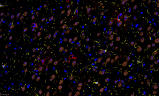 Absin 4-Color IHC Kit(Anti-Rabbit Secondary Antibody)