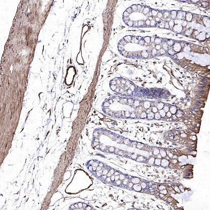 KL Recombinant Rabbit mAb (S-2245-169)