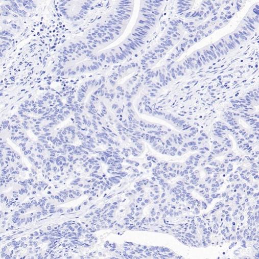 ALPP/ALPPL2 Recombinant Rabbit mAb (S-2089-36)