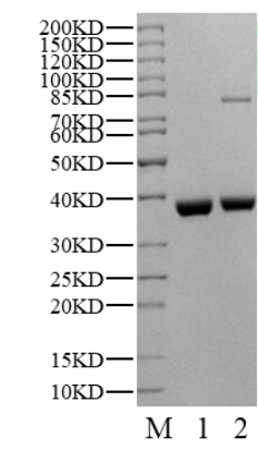 USP46 Protein, Human