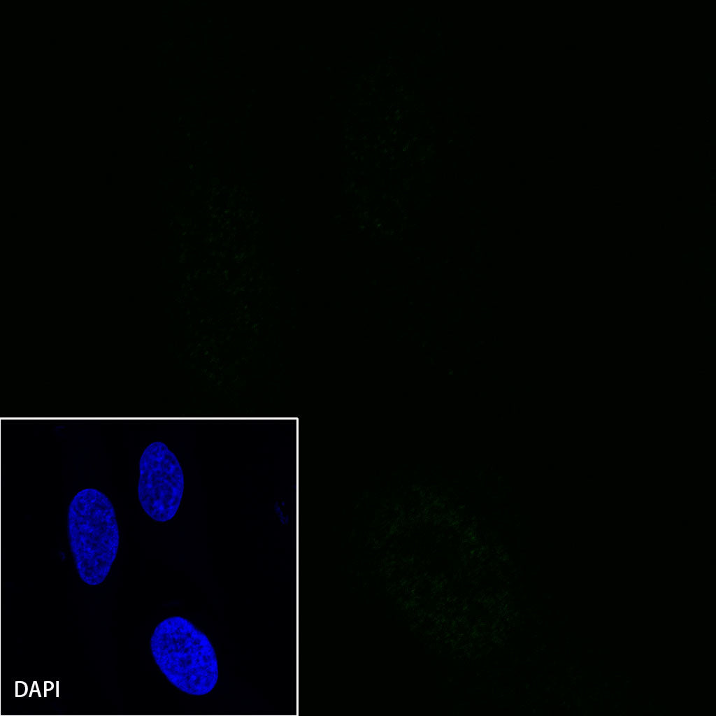 S-RMab® CD38 Recombinant Rabbit mAb (SDT-031-45-2)