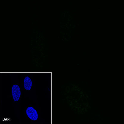 S-RMab® CD38 Recombinant Rabbit mAb (SDT-031-45-2)