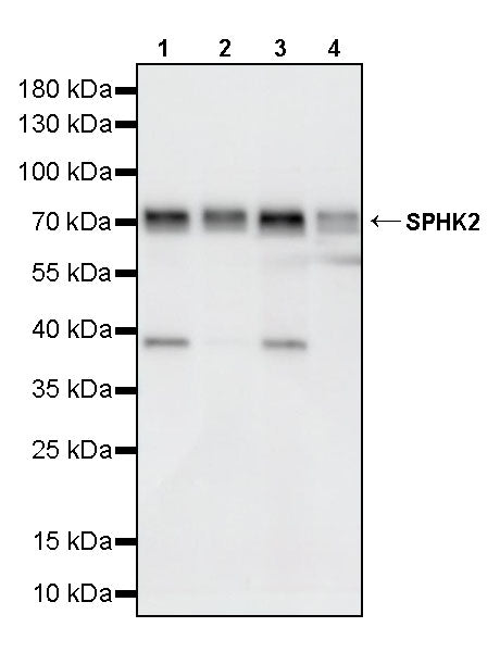 SPHK2 Recombinant Rabbit mAb (S-5307)