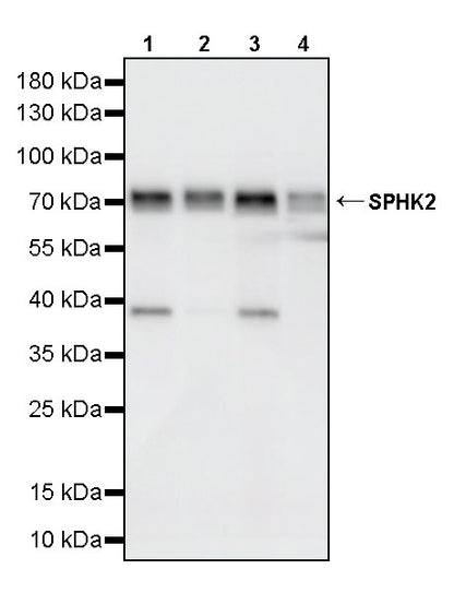 SPHK2 Recombinant Rabbit mAb (S-5307)