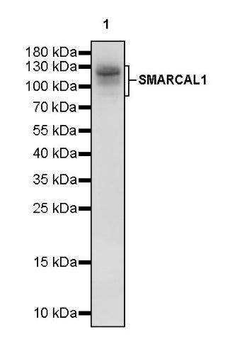 SMARCAL1 Recombinant Rabbit mAb (S-2110-328)