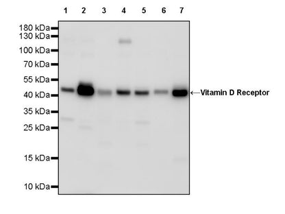 Vitamin D Receptor Recombinant Rabbit mAb (S-1719-7)