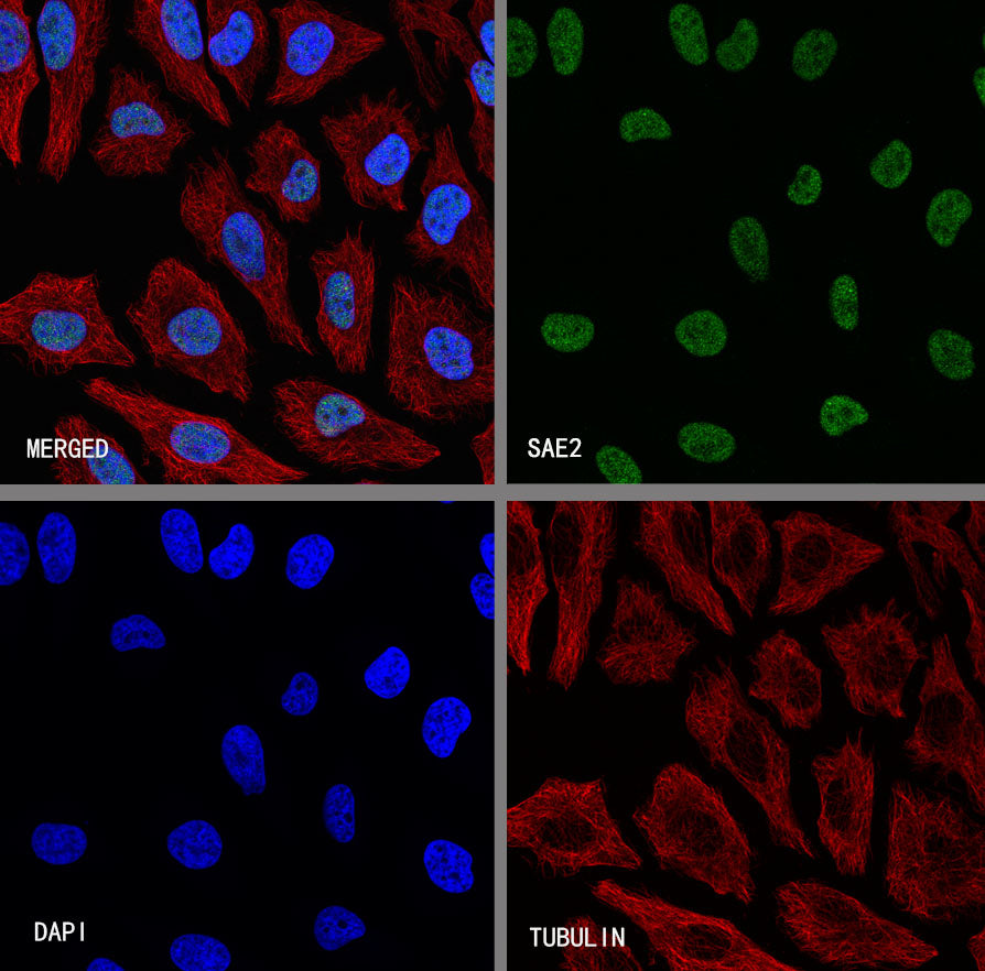 SAE2 Recombinant Rabbit mAb (S-4888-5)