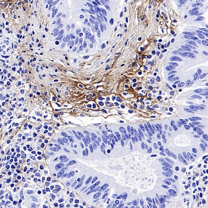 Tenascin C Recombinant Rabbit mAb (S-775-274)