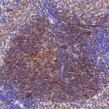 c-Rel Recombinant Rabbit mAb (S-1150-52)