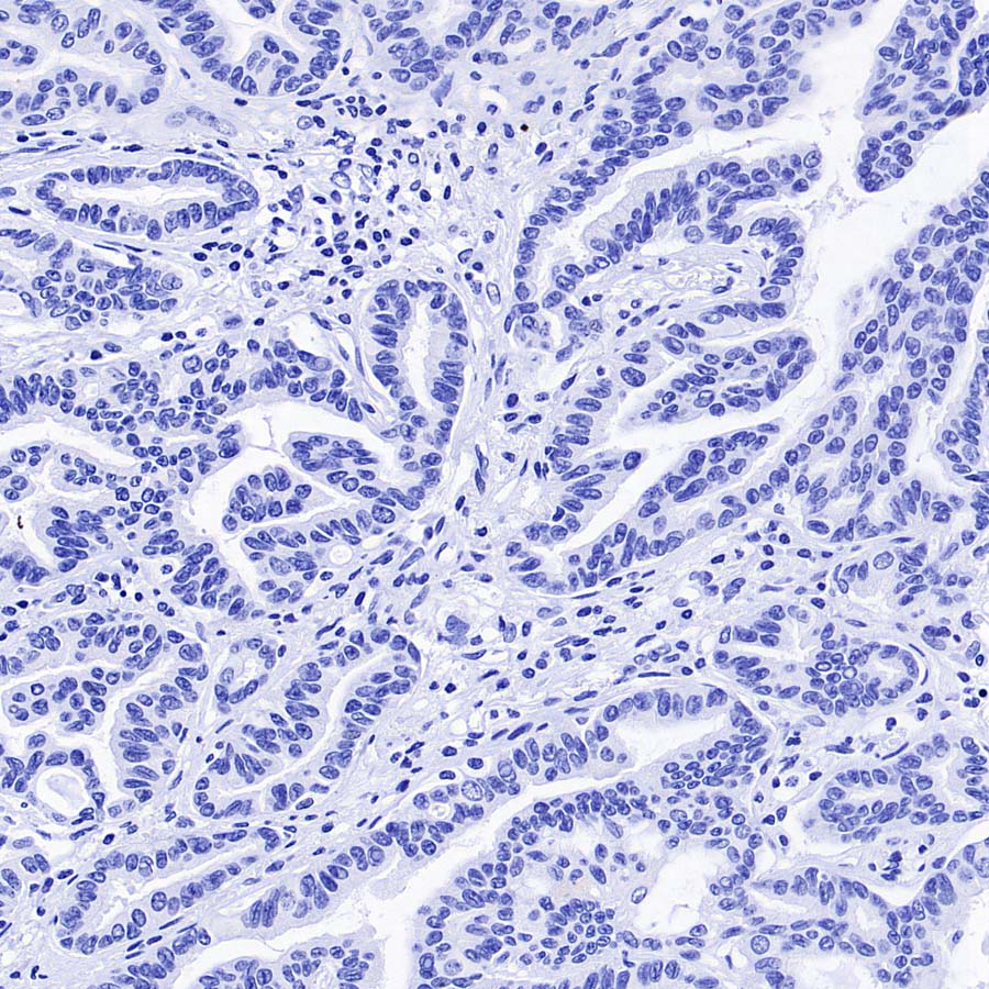 pan SCN Recombinant Rabbit mAb (S-5038)