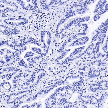 pan SCN Recombinant Rabbit mAb (S-5038)