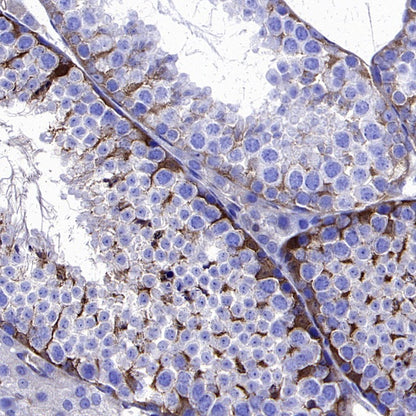 TFEB Recombinant Rabbit mAb (SDT-2411-7)