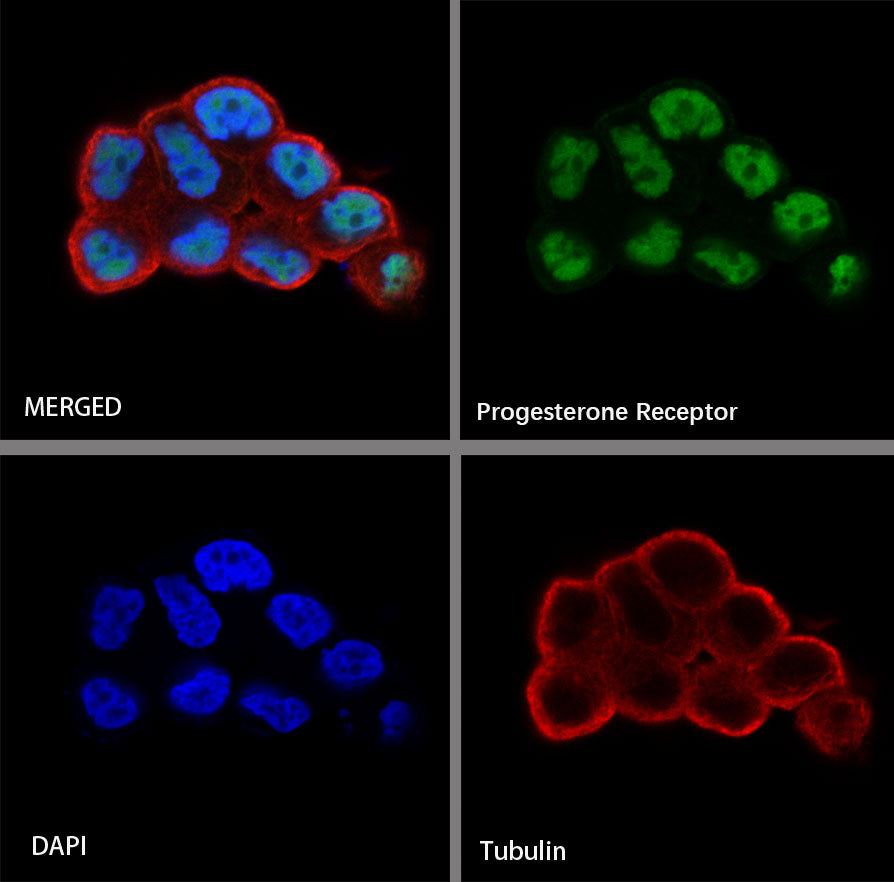 Progesterone Receptor Recombinant Rabbit mAb (SDT-R123)