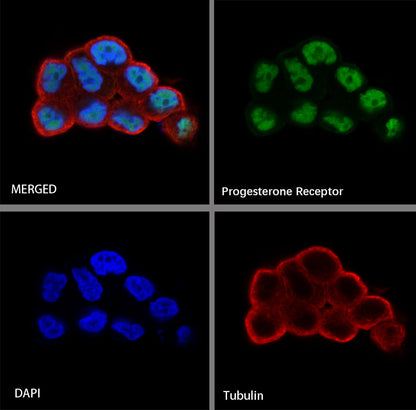 Progesterone Receptor Recombinant Rabbit mAb (SDT-R123)