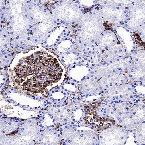 Galectin-1 Recombinant Rabbit mAb (S-1221-32）
